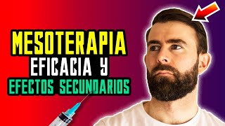 Mesoterapia Con Dutasteride Para Recuperar El Pelo [upl. by Nob]