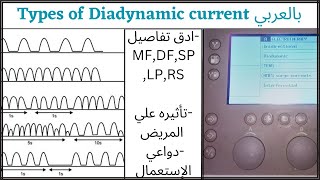 Types of diadynamic current بالعربيFixed monophasediphaseshort periodlong periodsyncopal rhythm [upl. by Lehcem]