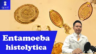 Conoce a Entamoeba histolytica morfología y CLAVES para su identificación🔬 [upl. by Mercer]