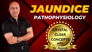 Pathophysiology Of Jaundice  Dr Najeeb Lectures [upl. by Burdelle]