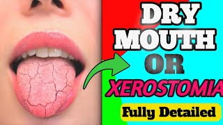 CAUSES OF XEROSTOMIA  MANGEMENT  DRY MOUTH 😍 [upl. by Godred]