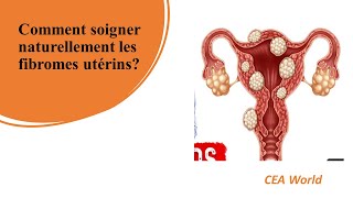 Comment soigner naturellement les fibromes utérins [upl. by Bernt]