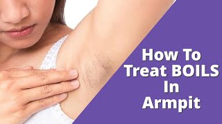 Home Treatment For Boils In Armpit That Works  Inflamed Cysts [upl. by Zoller]