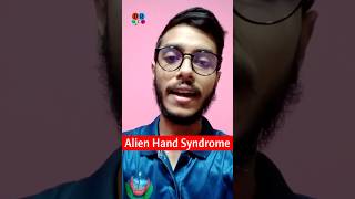 Alien hand syndrome  Alzheimers disease  Brain tumor  Dr Med  Sakib Rahaman [upl. by Uzzi]