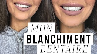 COMMENT JAI BLANCHI MES DENTS  MON BLANCHIMENT DENTAIRE [upl. by Arytas]