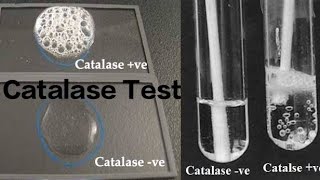 Catalase Test [upl. by Dyrrej727]