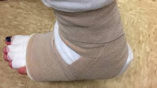 Leg Bandaging Lymphedema [upl. by Siuqram689]