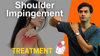 हाथ उठाने में कंधे में दर्द कैसे होगी ठीक  Shoulder Impingement Subacromial Bursitis Treatment [upl. by Hersh]