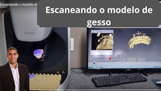 Escaneando o modelo de gesso dralexguedes [upl. by Mariska]