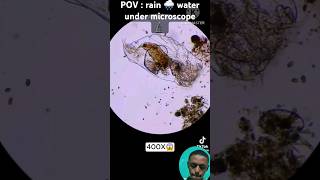 Rain 🌧 water under microscope😱😱😱😱💯💯 🔬 freepalestine science facts [upl. by Jamila]