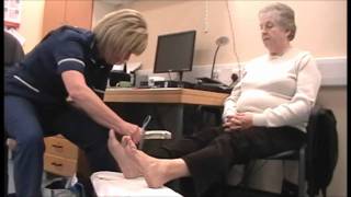 Diabetes Bites Diabetic Foot Examination [upl. by Simonette912]