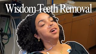 Unfiltered Wisdom Teeth Removal And My First Time On Anesthesia [upl. by Pulsifer]