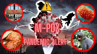 MPOX VIRUS another pandemic after corona virus news [upl. by Ecarret]