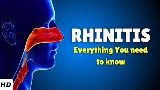 Rhinitis – Causes Types Signs and Symptoms Diagnosis amp Treatment [upl. by Enilarak]