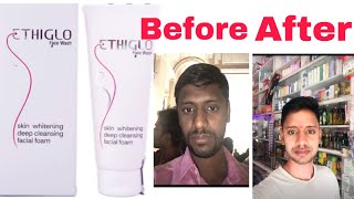 Ethiglo face wash 100 results [upl. by Amathist]