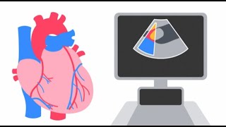 Understanding an Echocardiogram [upl. by Oiretule]