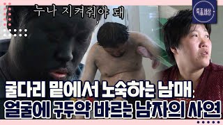 얼굴에 검은 구두약을 수시로 바르는 남자의 사연｜특종세상 333회 FULL영상 [upl. by Loats509]