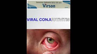 Virson ophthalmic gel  ganciclovir ophthalmic gel 015  virson eye ointment [upl. by Amikehs]