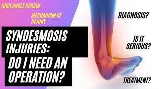 Syndesmosis Injury High Ankle Sprains [upl. by Jackelyn]