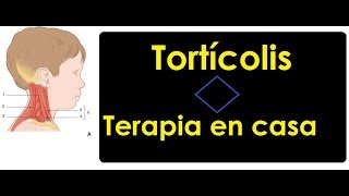 Tortícolis congénita tensión en cuello  Terapia en casa [upl. by Adnoel]