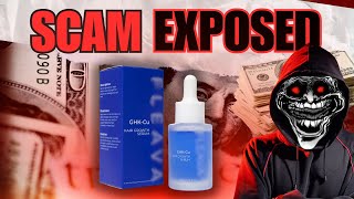 Exposing A Hair Loss SCAM [upl. by O'Grady]