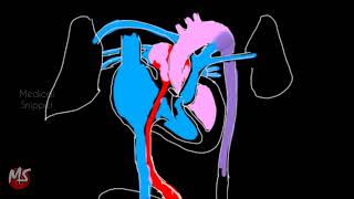 Fetal Circulation  Anatomy  Made easy  3 minutes [upl. by Aniretak40]