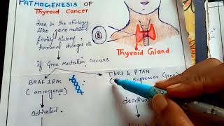 pathogenesis of thyroid cancer NGMedicals [upl. by Divaj]