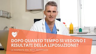 Liposuzione Dopo quanto tempo si vedono i risultati della liposuzione  Dott Renato Zaccheddu [upl. by Ontine]