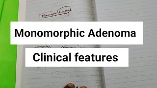 Monomorphic Adenoma salivaryglands [upl. by Areemas193]