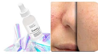 The Ordinary Niacinamide10Zinc1  Acne Open Pores  Wrinkles Use Ordinary Serum By Rukhma Naveed [upl. by Osbert]