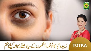 Zubaida Apa Totkay  Ankhon Ke Halke Khatam Karne Ka Tarika  Dark Circles Ka Ilaj  Masala TV [upl. by Kahl722]