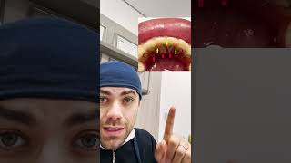 A melhor contenção ortodôntica dentista [upl. by Arber]