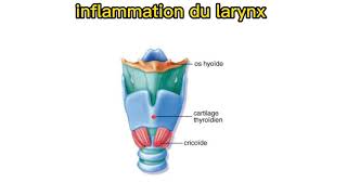 laryngite aiguë pédiatrie [upl. by Anurag]