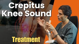 घुटने में काट काट की आवाज़ कैसे करें ठीक  Crepitus Knee Sound Best Treatment [upl. by Naghem]