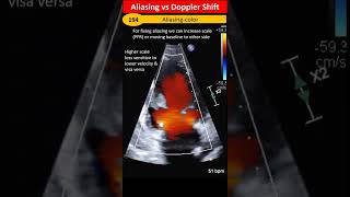 Aliasing vs Doppler Shift [upl. by Marilla414]