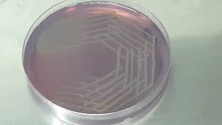 Stenotrophomonas maltophilia colony morphology on CLED agar [upl. by Otreblig]