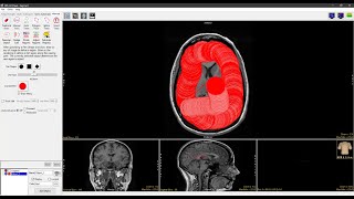 Analyze 150  Segment Freehand Draw 2D Region Definition [upl. by Elakram580]