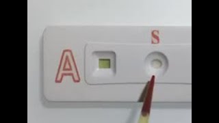 Paper strip test determines blood type [upl. by Hgielyak]