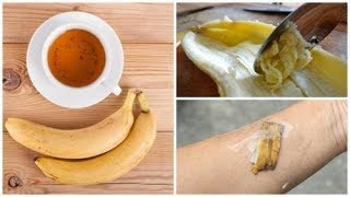 5 Verwendungsmöglichkeiten von Bananenschalen als Naturheilmittel [upl. by Mihsah]