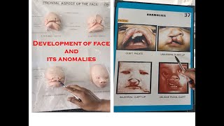 Development of face and its developmental anomalies  Explained with embryology model  made easy [upl. by Nnairrek]