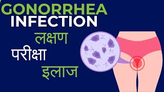 Gonorrhea symptoms in men  Gonorrhea kya hota hai  kaise hota hai  Diagnosis and treatment [upl. by Felizio]