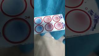 Agglutination test mixing procedure [upl. by Novi]