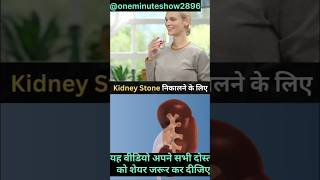 Kidney stone किडनी स्टोन को कैसे बाहर निकल जाए। kidneystones ratantata bharatratanforratantata [upl. by Bagley329]