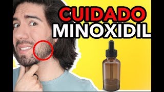 CUIDADOS AL USAR MINOXIDIL  JM Montaño [upl. by Nodnorb856]