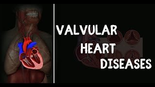 Valvular Heart Disease [upl. by Linsk]