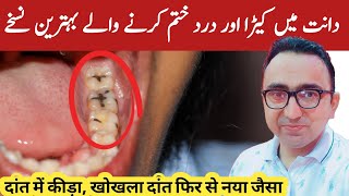 Top 4 Home Remedies For Tooth Cavity  Dental Carries  Dr Javaid [upl. by Ybsorc304]