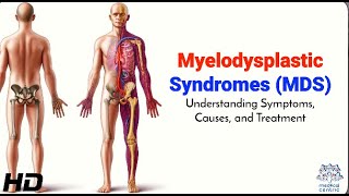 Myelodysplastic Syndromes MDS Symptoms Diagnosis and Treatment [upl. by Shum]