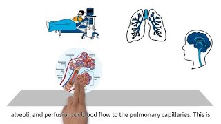 MedEd capnography byte 4 Ventilation perfusion mismatching [upl. by Fisoi457]