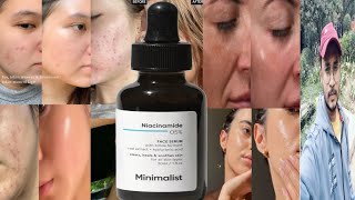 Minimalist Niacinamide 5 Face Serum  Honest Review [upl. by Belden]