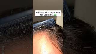 🔥Most Powerfull Anti Dandruff Shampoo Hack ❤️  Hair Growth Tips ✅ shorts youtubeshorts [upl. by Akinoj]